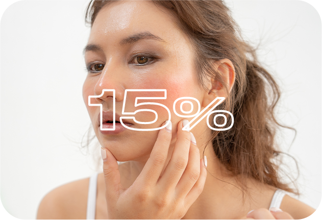 常に敏感肌　15％