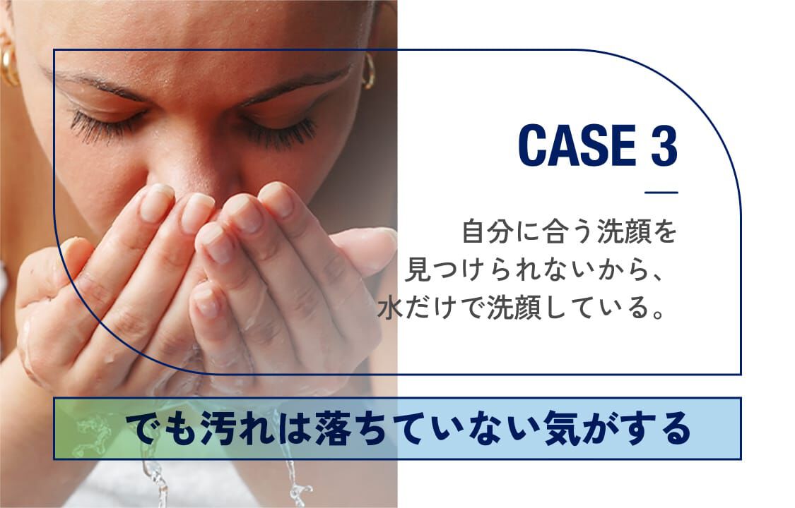 CASE3「自分に合う洗顔を見つけられないから、水だけで洗顔している。」でも汚れは落ちていない気がする