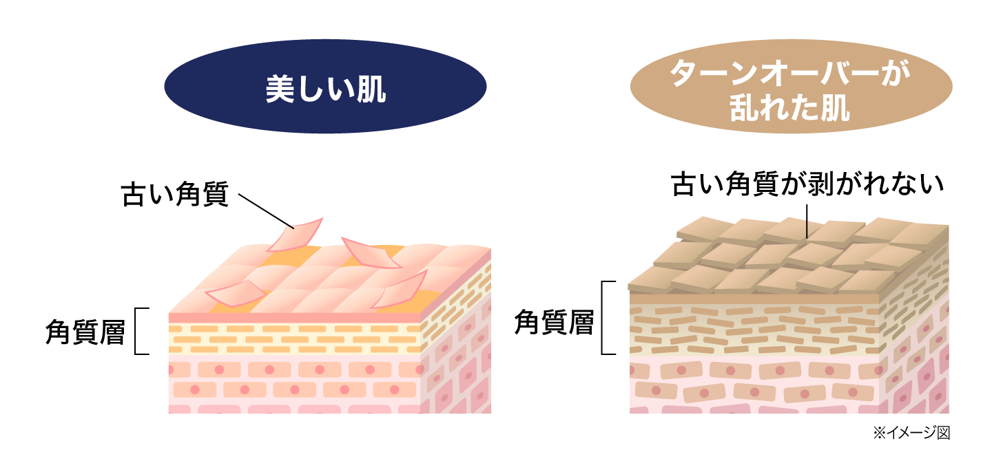 肌への刺激や不快感に対する不安の円グラフ